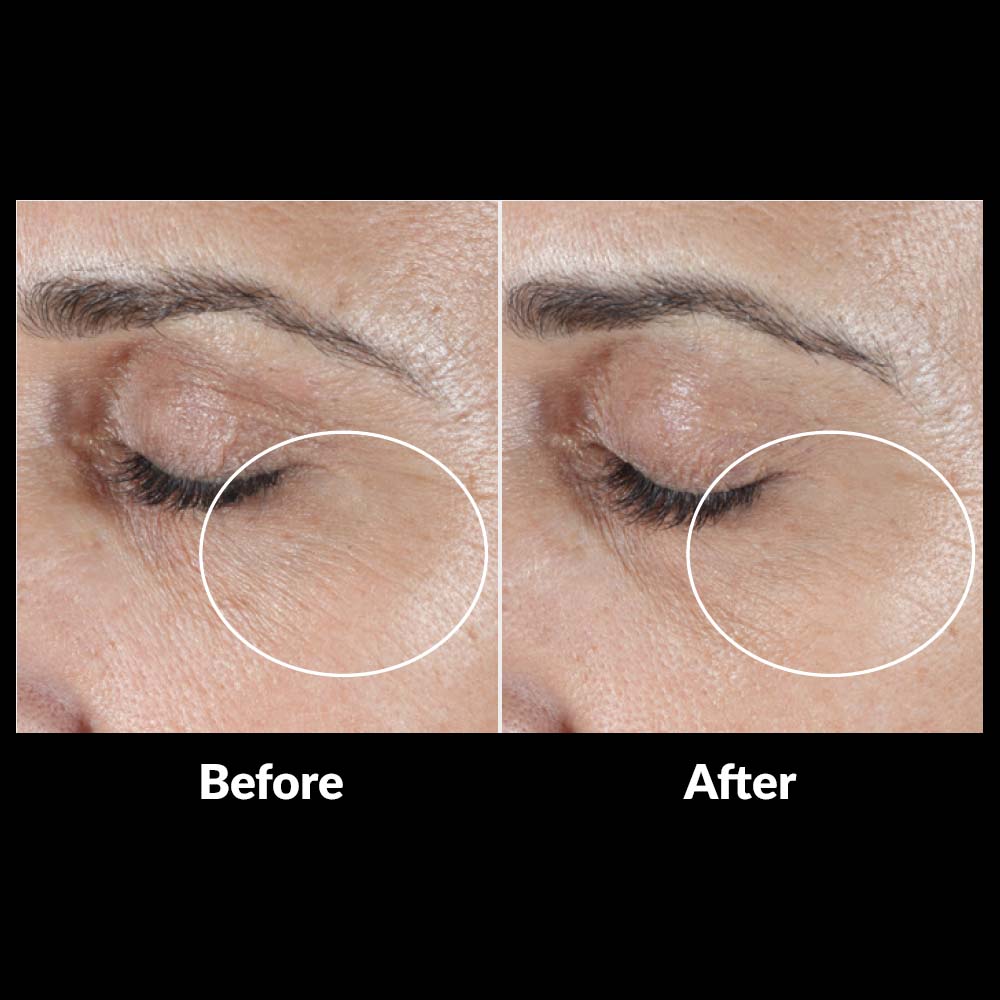 SkinMedica® HA5® Rejuvenating Hydrator - 1 oz