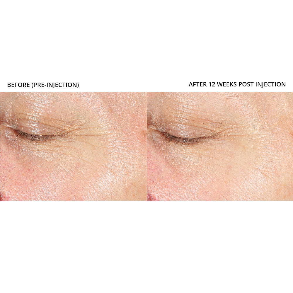 Revision Skincare Revox™ Line Relaxer