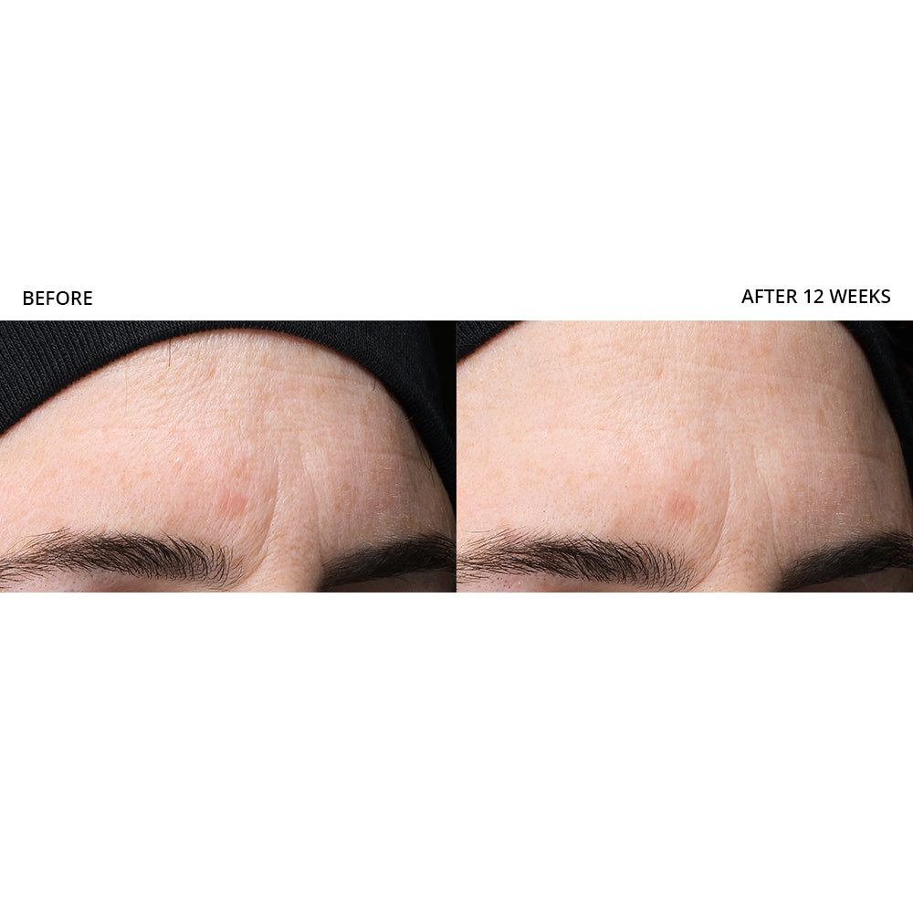 Revision Skincare Revox™ Line Relaxer