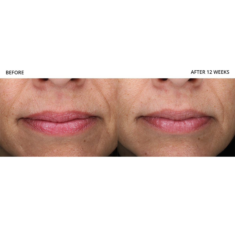 Revision Skincare Revox™ Line Relaxer