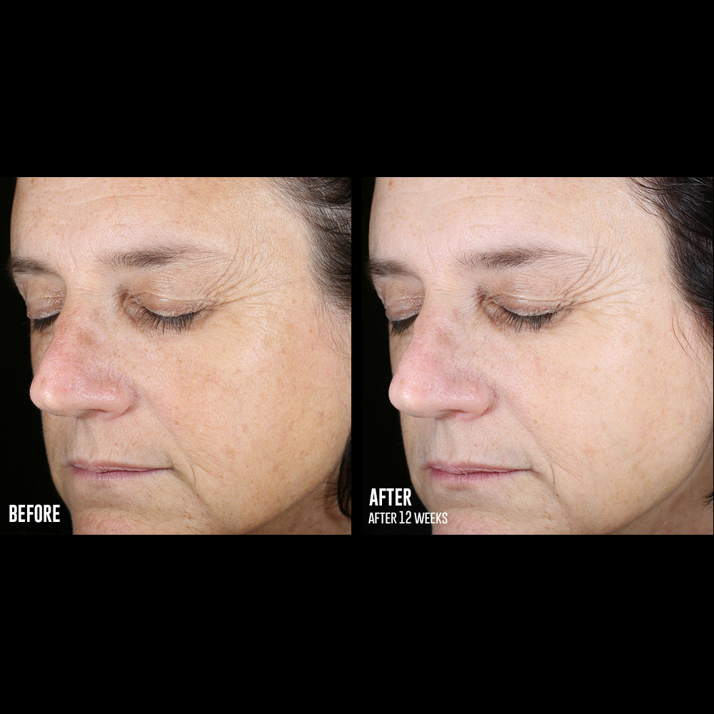 skinbetter science® Even Tone Correcting Serum™