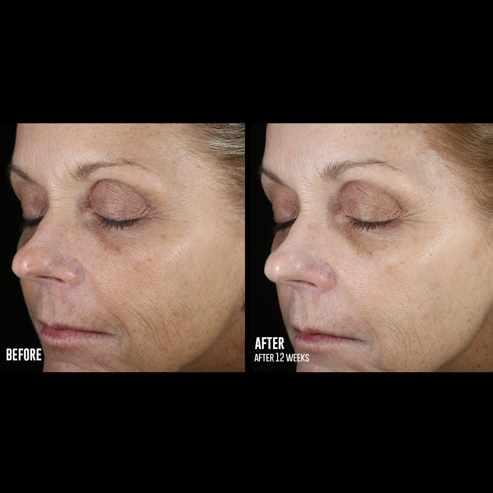 skinbetter science® Even Tone Correcting Serum™