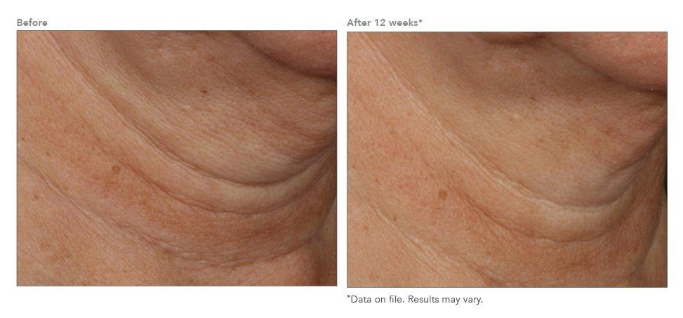 Revision Skincare® Nectifirm® ADVANCED