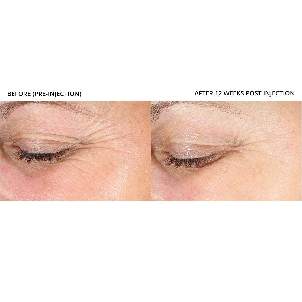 Revision Skincare Revox™ Line Relaxer