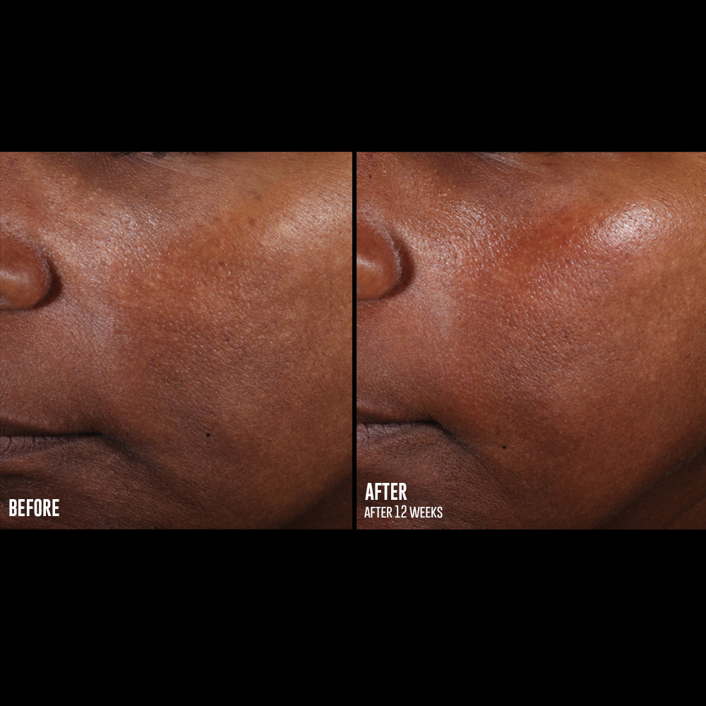 skinbetter science® Even Tone Correcting Serum™