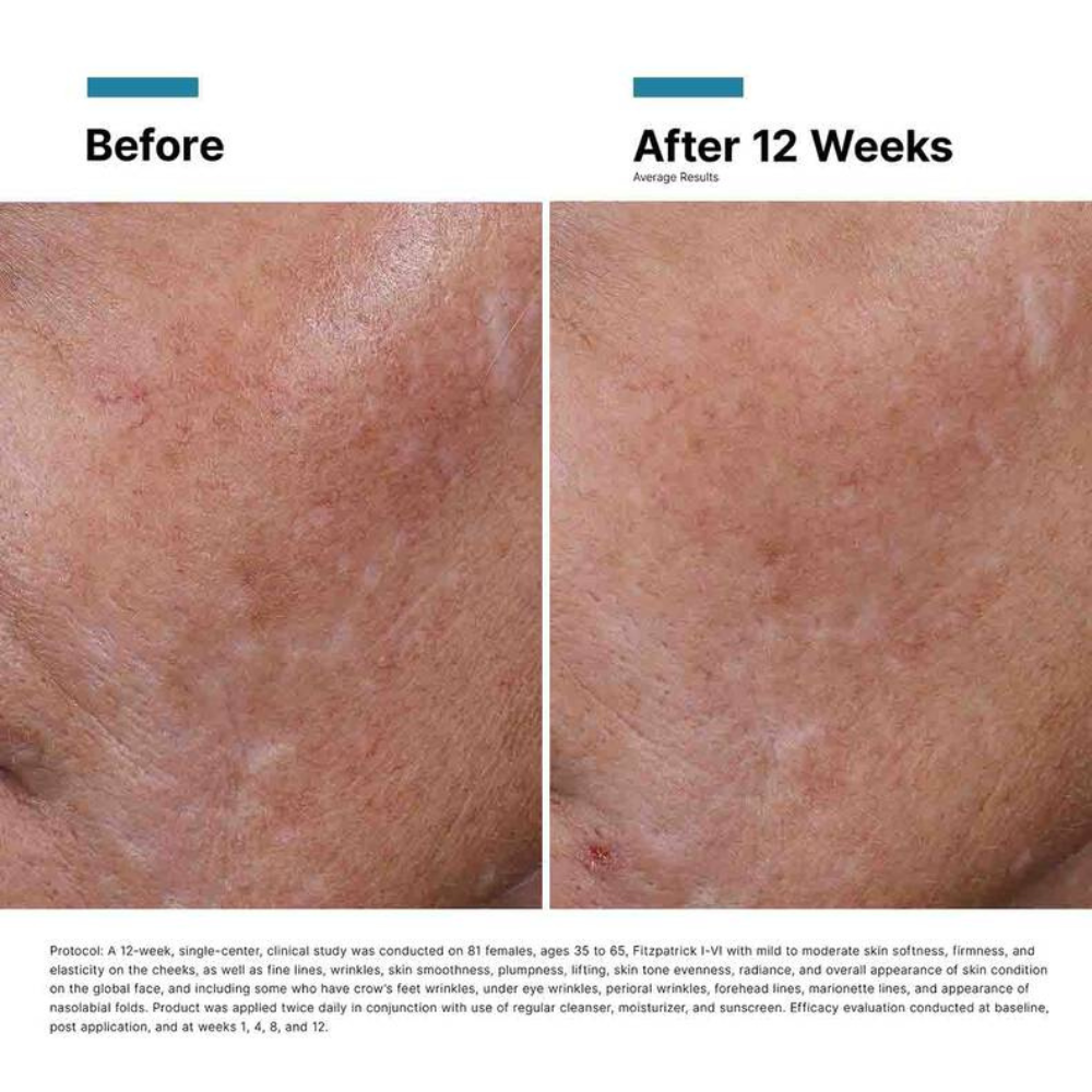 SkinCeuticals Hyaluronic Acid Intensifier Multi-Glycan